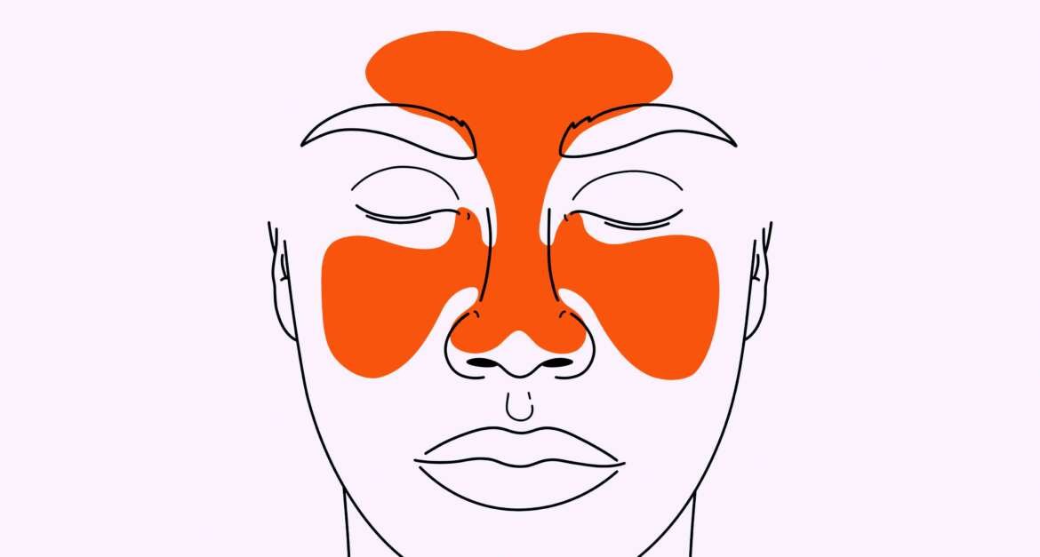 Sinus Surgery -FESS-Septoplasty