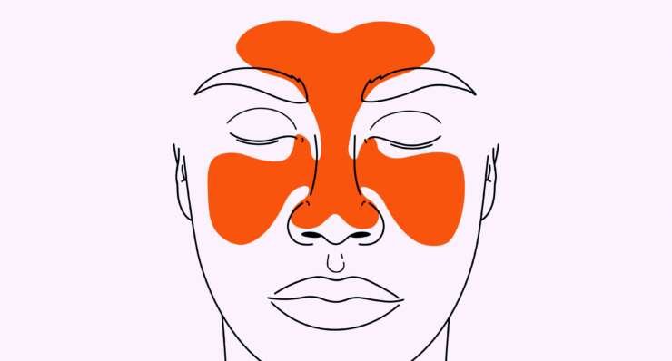Sinus Surgery -FESS-Septoplasty