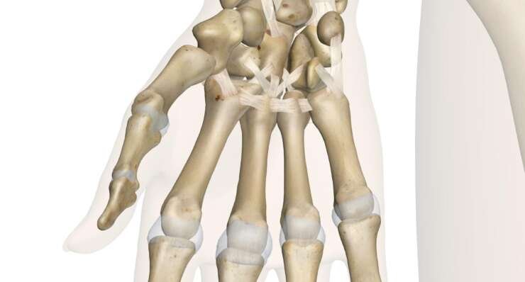 Hand & Wrist Pain